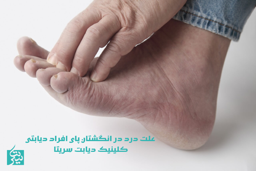 درد انگشتان پای دیابتی