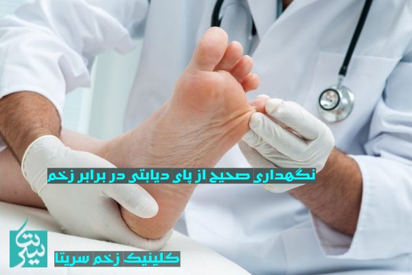 نگهداری صحیح پای دیابتی