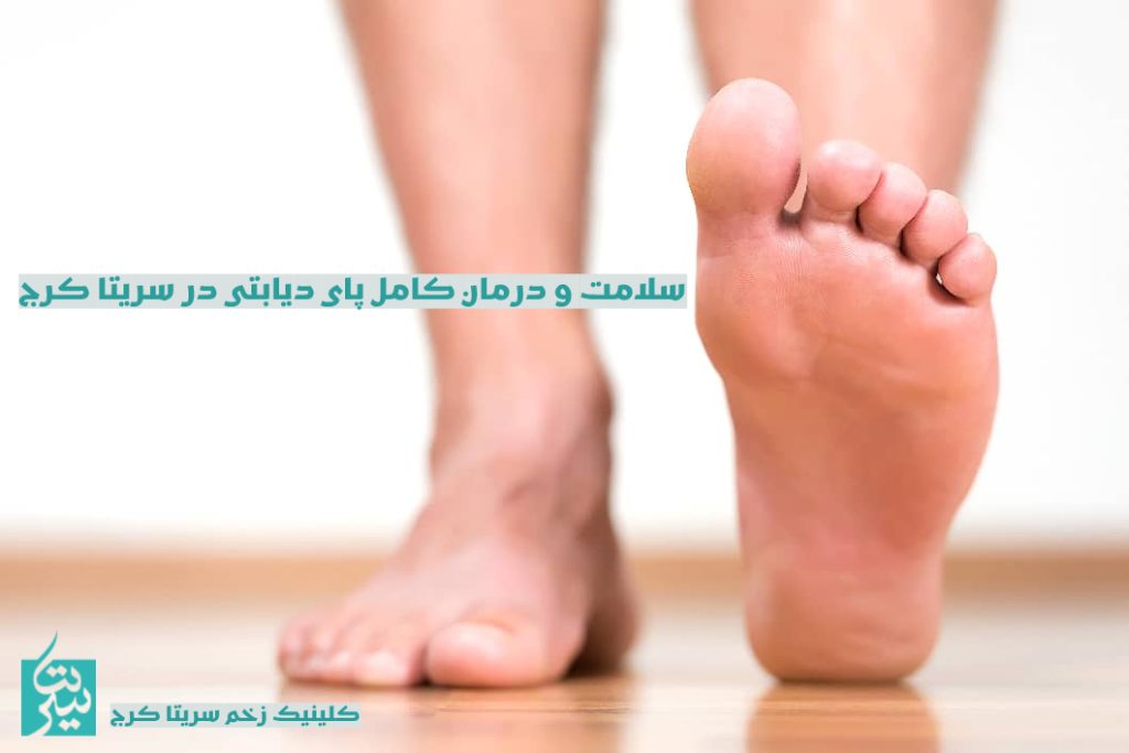 بهترین کلینیک زخم در کرج