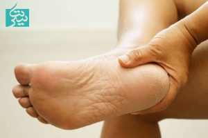 برای بهبود زخم دیابت چه باید کرد؟